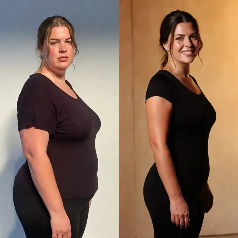 lipoless antes e depois mariana