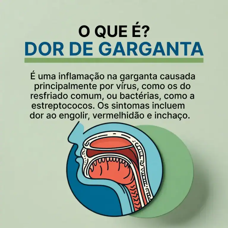 o que é dor de garganta?
